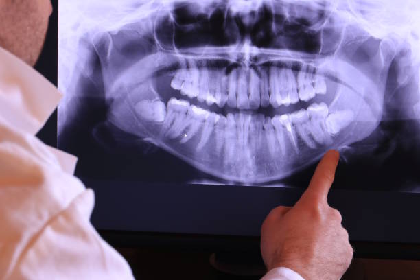 Best Emergency Treatment for Dental Infections or Abscesses in Carlisle, IA